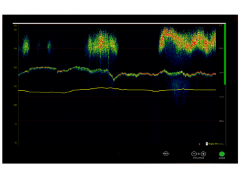 TrawlSonar_TS-360_fish